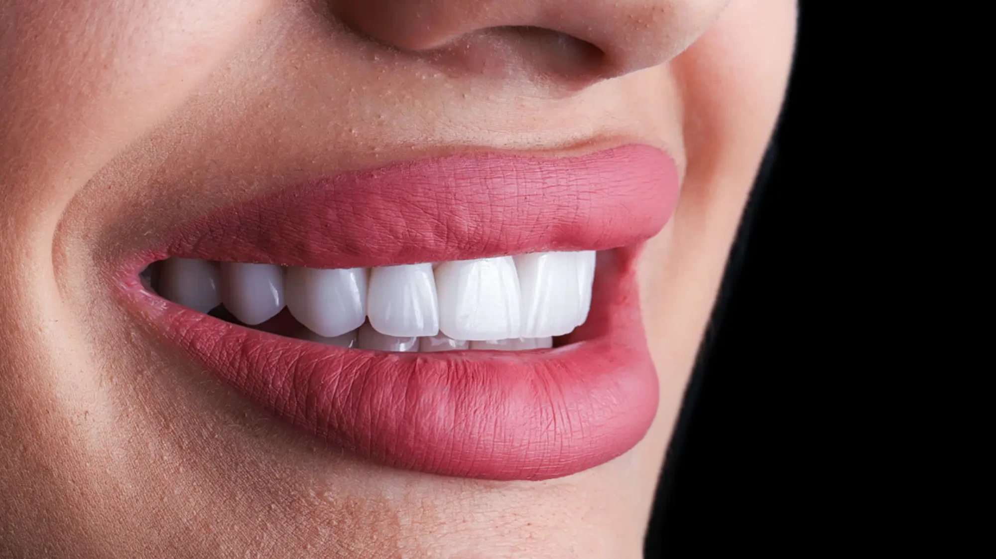 Zirconium Dental Crowns